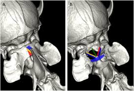 Maybe you would like to learn more about one of these? Morphometric And Functional Study Of The Canine Atlantoaxial Joint Sciencedirect