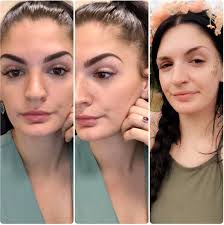 This will lift up the cheeks and the nose. Advice I Ve Got An Asymmetrical Face And Brows Filled In Brows Vs No Makeup Fixedeyebrows