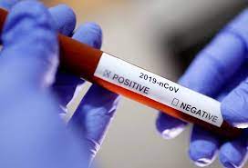 Junit test cases are organize into corona test suites. Major Milestone India Conducts 1 Million Coronavirus Tests
