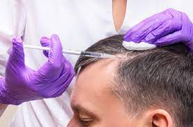 It may help restore hair growth. Prp For Hair Loss Singhania Skin Clinic