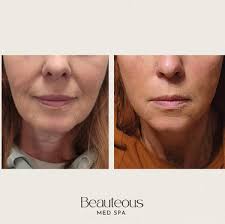 Enhance Your Confidence at Beauteous Med Spa