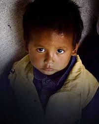 Acupuncture Relief Project