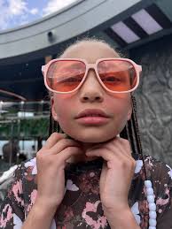 Our girl who was suffering from chlorine toxicity is practicing being  adorable today...But don't let those cute eyes fool you; she is spicy! 🔥  She is doing significantly better, and is officially