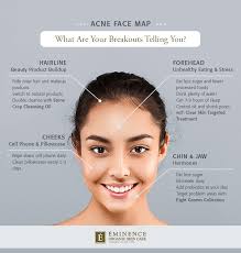 Banish blemishes on the daily with our acne control tea tree cleanser. Acne Face Map What Are Your Breakouts Telling You Eminence Organic Skin Care