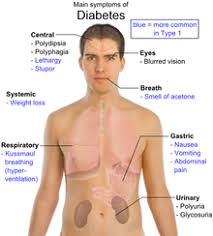 In some cases, diabetic ketoacidosis or hyperosmolar syndrome is the first sign that a person has diabetes. Signs And Symptoms Of Diabetes Mellitus Medicaldoctor S Blog