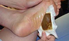 Faites Des Patchs Detox A La Maison Et Supprimez Toutes Les Toxines Dangereuses De Votre Corps Pendant La Nuit San Foot Detox Pads Foot Detox Detox Your Body