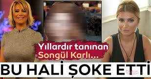 Hadi bir tane sosyal medyaya koyayım dedim, olay oldu dedi. Songul Karli Nin Bu Hali Olay Oldu Iste Songul Karli Nin Soke Eden Fotografi Son Dakika Haberler