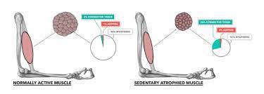 Sarcopenia is a progressive and generalised skeletal muscle disorder that is associated with increased likelihood of adverse outcomes including falls, fractures, physical disability and mortality (1). Crossfit Muscle Basics Part 4 Atrophy Sarcopenia