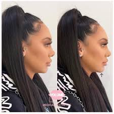 Brian N Huh, MD, 520 S Virgil Ave, Ste 300, Los Angeles, CA