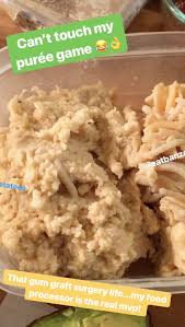 Check spelling or type a new query. The Best Gluten Free And Vegan Soft Foods To Eat After Dental Surgery Part 2