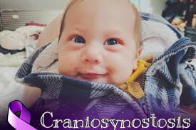 Fundraiser for Kaden Walters-Festarini by Kara Trussler : Eli's  Craniosynostosis Journey