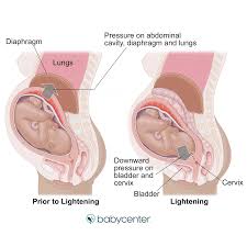 As babies can't tell us when they are in pain, it can be hard to assess whether pain medication is working. slater and her colleagues are working on changing this by showing that the infant brain is activated during painful procedures. Lightening When Your Baby Drops Into Your Pelvis Babycenter