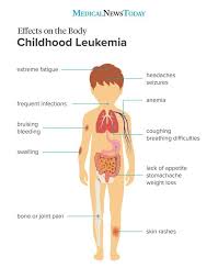 Leukemia Symptoms Children Cancer Nurses Leukemia Symptoms Childhood Cancer Awareness Month