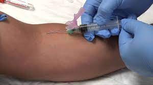 Maybe you would like to learn more about one of these? Phlebotomy Syringe Draw Procedure Blood Collection Rx Tn Youtube