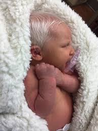 The little darling weighed 8 this content is imported from instagram. Baby Born With Striking White Hair Looks As Fragile As A Doll Jesus Daily