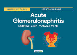 Expedite the admission process and initiate bedrest for client. Acute Glomerulonephritis Nursing Care Planning And Management