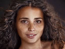 Image result for Freckled skin