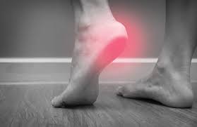 Kuru® heel spur shoes mold to feet. Heel Spurs
