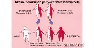 Penyakit Thalasemia Pengertian Jenis Gejala Penyebab Dan Pengobatan Berbagi Cerita Opini Edukasi Dan Hiburan Jenis Penyakit Kesehatan