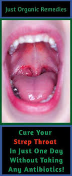 Strep Throat Is Caused By The Streptococcus Pyogenes Bacteria And Is More Common In Children I Strep Throat Remedies Natural Strep Throat Sore Throat Remedies