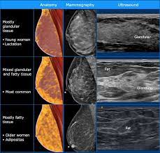 Breast ultrasound breast ultrasound uses sound waves to make a computer picture of the inside of the breast. The Radiology Assistant Ultrasound Of The Breast