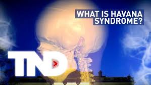 American diplomats and cia officers there started suffering what was dubbed havana syndrome.. Tnd What Is Havana Syndrome Youtube