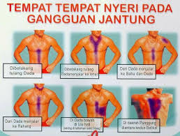 Rasa sakit yang anda alami bisa saja berbahaya, bisa juga tidak. Tanda Tanda Awal Medic Care Services Ambulance Facebook