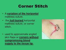 Image result for Corner Stitch