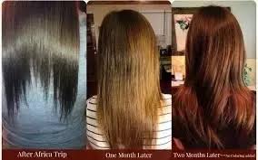 How Does Hair Look Before And After Biotin Treatment Quora