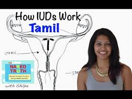 You can also add a definition of iud yourself. How An Iud Works Tamil Youtube