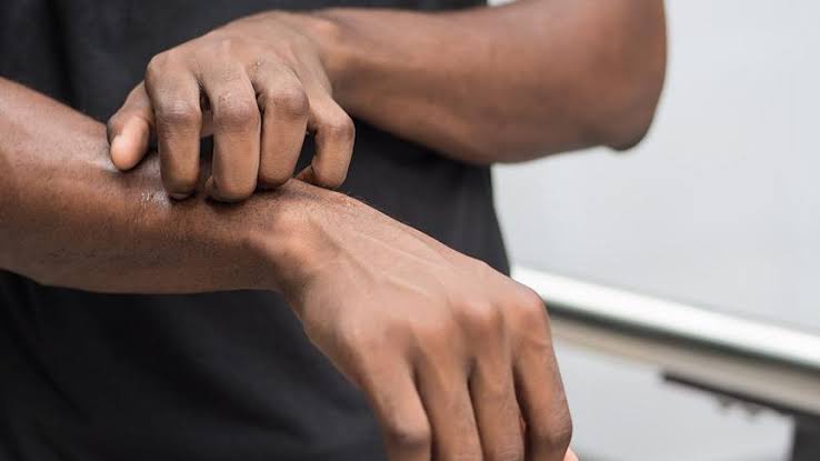 kaşıntı sözcü ile ilgili görsel sonucu"