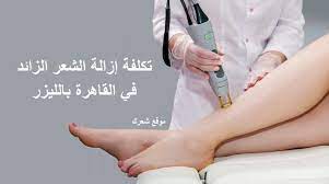 أبيض حليبي توصيل ثلاثون ازالة الشعر بالليزر سعر pikespeakriders org