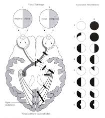 Stroke Medicine For Stroke Physicians And Neurologists