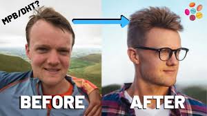 Not to put much faith in vitamin supplements like biotin that purport. Head And Shoulders Shampoo Does It Cause Hair Loss Youtube