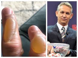 Old footballer and crisp magnate. Gary Lineker Verbrennt Sich Die Finger Der Anblick Schockt