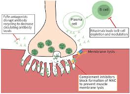 Myasthenia gravis is the most common disorder of the neuromuscular junction. Neuromuscular Notes Next Generation Treatments For Myasthenia Gravis Practical Neurology