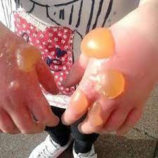 Нежные молодые стебли с ещё не развитыми цветками употребляются в солёном виде (обданные кипятком), а также поджаренные в масле с мукой. Borshevik Sosnovskogo Uchenye Schitayut Chto Rech Idet Ob Ekologicheskoj Katastrofe Yadovitoe Rastenie Zahvatilo Tverskuyu Oblast I Drugie Regiony Strany Tver24 Novosti V Tverskom Regione