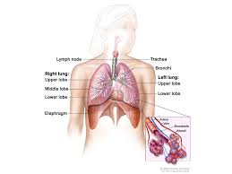 Know the signs and symptoms! Alecensa Alectinib For The Treatment Of Alk Positive Non Small Cell Lung Cancer Nsclc Clinical Trials Arena