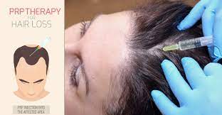 The treatment of hair loss by lasers is one of the ways in which doctors and patients use it to promote hair growth and encourage follicles to reproduce hair. Stem Cells And Prp Therapy Haartransplantation Fur Geheimratsecken Und Glatzen
