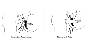 Check spelling or type a new query. Vaginismus Hypnotherapy Melbourne Sexual Therapist Julie Lorenz