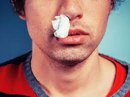 Kalau untuk menanganinya tentunya ada penanganan medisnya dengan obat atau. Ini Penyebab Hidung Sering Tersumbat Sebelah Saat Flu Health Liputan6 Com
