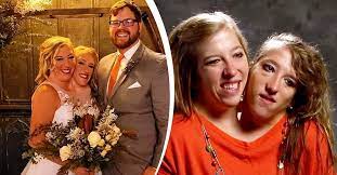 Conjoined Twin Abby Hensel Got Married In 2021