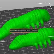 Image result for Demodex folliculorum