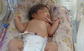 Operaron con éxito a Julián, el bebé bahiense que nació con una  malformación - La Brújula 24