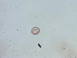 Image result for Pentarhopalopilia umbellulata