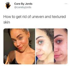 Maybe you would like to learn more about one of these? Care By Jords How To Get Rid Of Uneven And Textured Skin Facebook