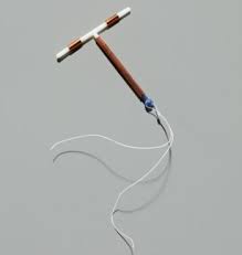 Still, when exchanging the hormonal iud with the copper iud, within a few days i felt alive again. Copper Iud California Family Pact