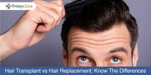 In this technique, new hair extensions either natural or artificial are attached to your existing hairs. Hair Weaving Or Hair Transplant Which Is Better Pristyn Care