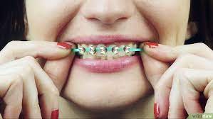 How To Make Fake Braces 11 Steps With Pictures Fake Braces Diy Braces Fake Earrings