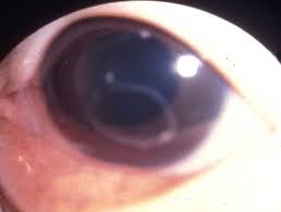Cats can pick up worms practically everywhere, so it's surprising when cats get them, especially the ones who rarely or never leave the house. Zoonotic Helminths Affecting The Human Eye Parasites Vectors Full Text